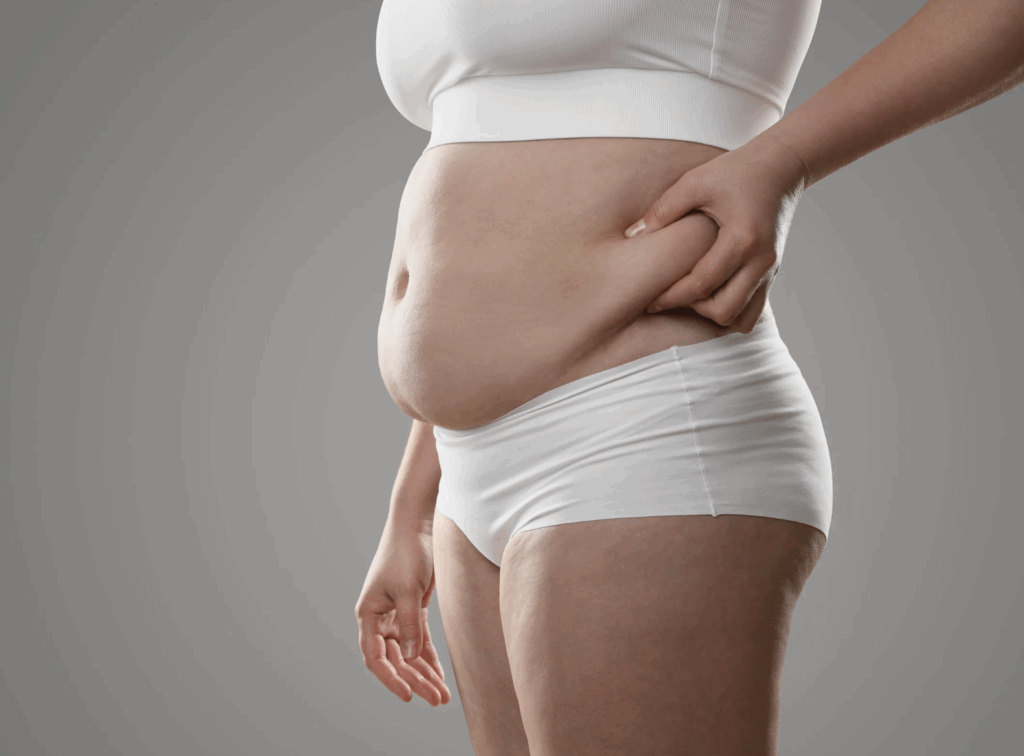 O que Ninguém Está Falando Sobre Obesidade e Lipedema: Desafios e Avanços Científicos